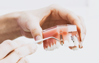 What Should You Do if You Suffer a Dental Injury at Work?