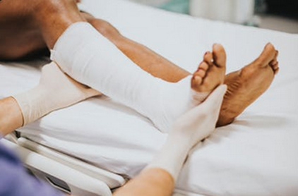 Illinois Workers’ Compensation Benefits for Bone Fracture Injury